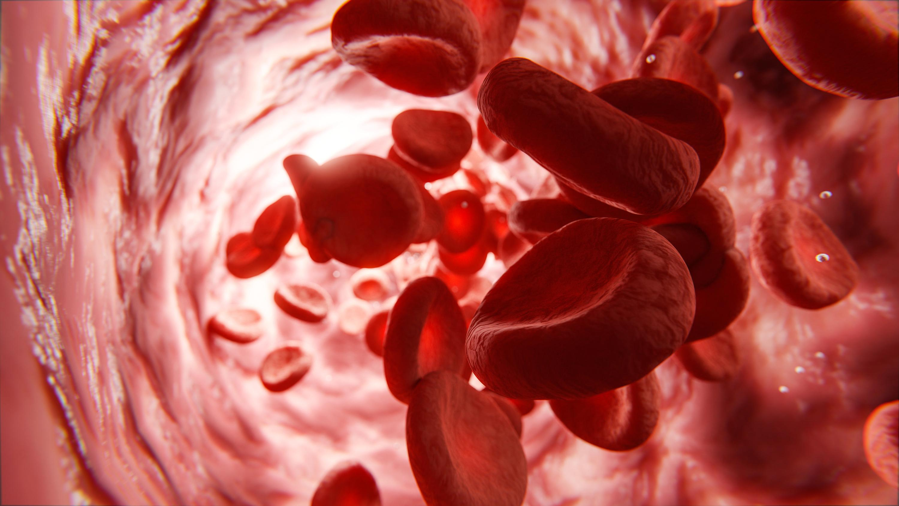 Long Covid: a step towards a blood test to facilitate diagnosis