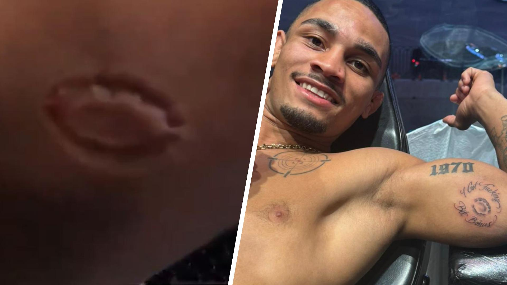 MMA: bitten by his opponent, he wins the fight and has teeth marks tattooed on his body