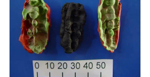 In Sweden, prehistoric “chewing gum” reveals its mysteries