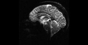 Here are the first brain images revealed by the most powerful MRI in the world